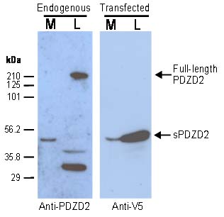 PDZD2 western blot